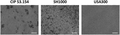 Staphylococcus aureus Strain-Dependent Biofilm Formation in Bone-Like Environment